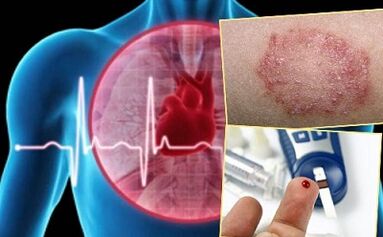 Against -indications for lipolifting