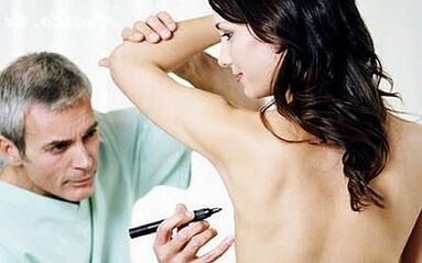 Surgical Method of Breast Increase