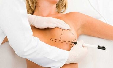How to increase the brain of implants