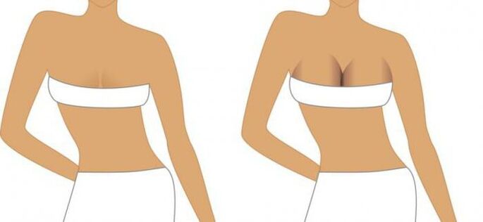 Post -operative period