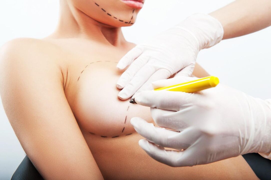 appointments before breast augmentation surgery